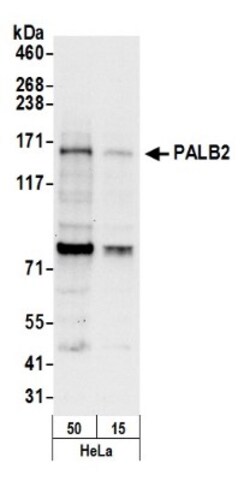 PALB2 Antibody, Novus Biologicals 0.1mg; Unlabeled:Antibodies, Polyclonal